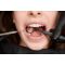 Abces dentar: tipuri, simptome, diagnostic si tratament stomatologic