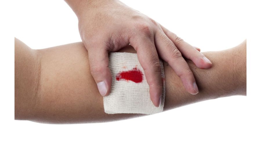 Plaga deschisa: Cauze, tratament, ingrijire pentru o vindecare optima si sfaturi pentru ingrijirea plagii dupa o operatie