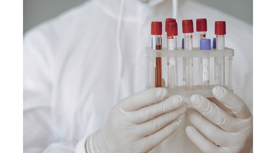 Probele biologice – ce reprezinta acestea si de ce trebuie sa li se acorde o atentie sporita?