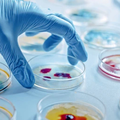 Medical Laborator/CONSUMABILE LABORATOR/Cutii Petri