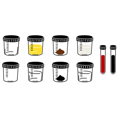 Medical Laborator/CONSUMABILE LABORATOR/Recipiente Recoltare