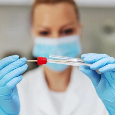 Medical Laborator/CONSUMABILE LABORATOR/Exsudat Faringian