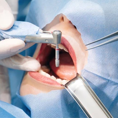 Stomatologie Cabinet/FREZE DENTARE