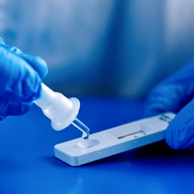 Medical Laborator/TESTE LABORATOR